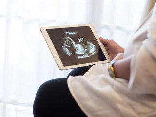 Mujer embarazada observando una ecografía